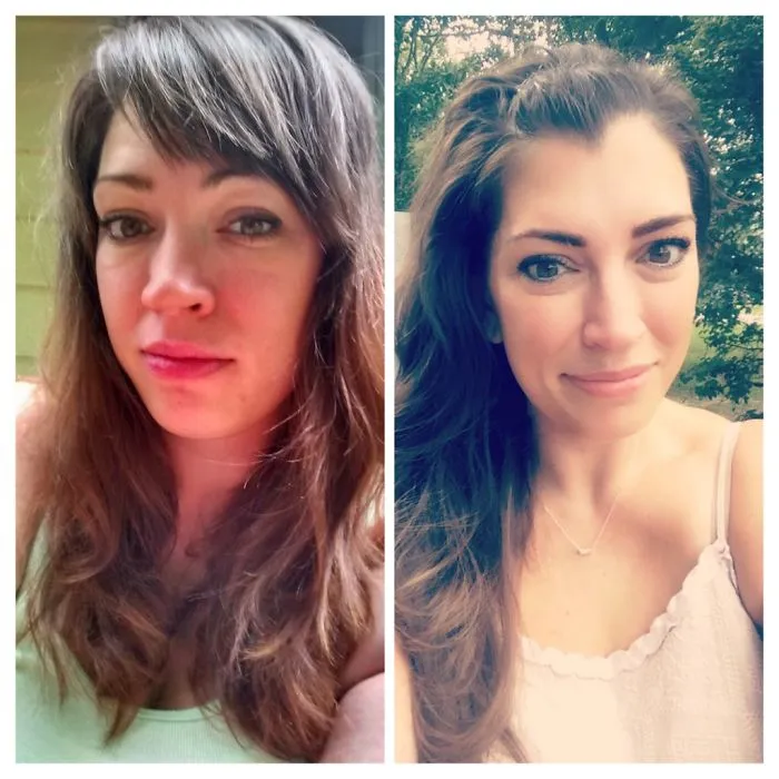 Side-by-side before and after photos showing a woman’s improved skin and glow after stopping drinking alcohol.
