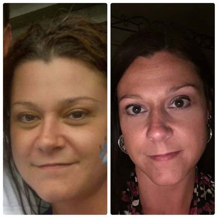 Before and after comparison of woman showing impact of quitting drinking.