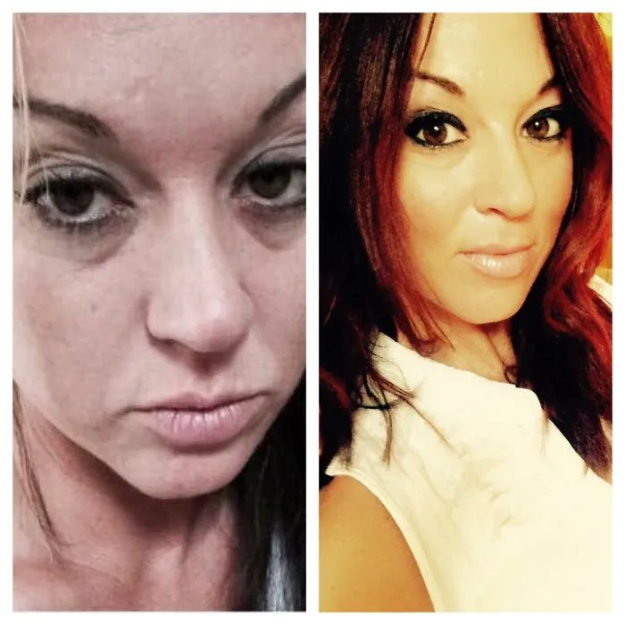 Side-by-side before and after pics showing visible improvement after quitting drinking, highlighting recovery benefits.