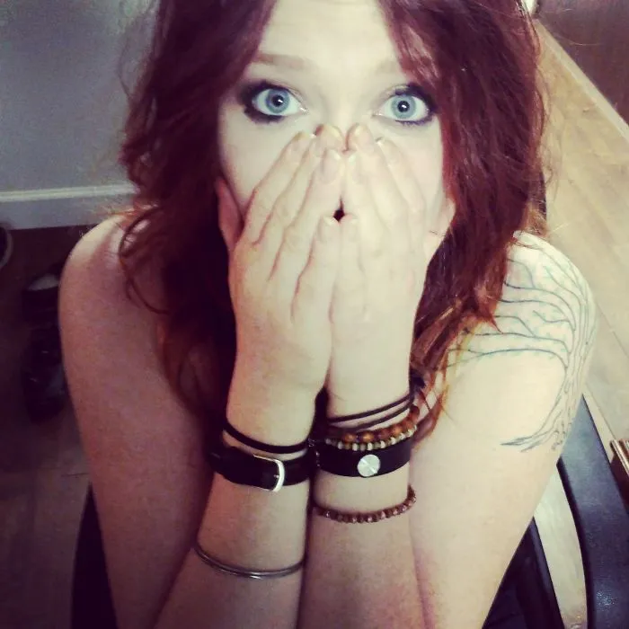 A Red Head Who Recently Cured Her Debilitating Subhorreic Dermatitis Hand Eczema