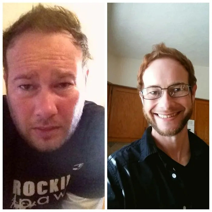 Side-by-side before and after photos of a man showing improved appearance after quitting drinking.