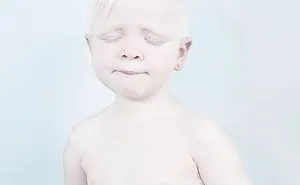 58 Albino People Who'll Mesmerize You With Their Otherworldly Beauty