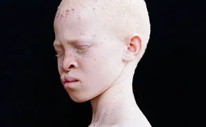 58 Albino People Who'll Mesmerize You With Their Otherworldly Beauty