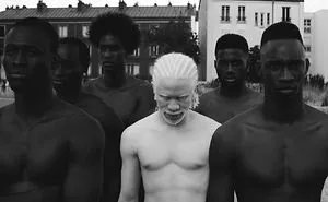 58 Albino People Who'll Mesmerize You With Their Otherworldly Beauty