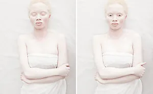 58 Albino People Who'll Mesmerize You With Their Otherworldly Beauty