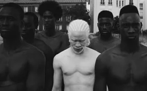 58 Albino People Who'll Mesmerize You With Their Otherworldly Beauty