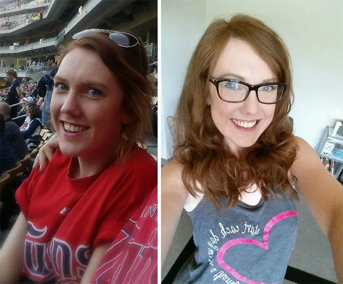 Before-and-after images showing the transformation when you stop drinking.