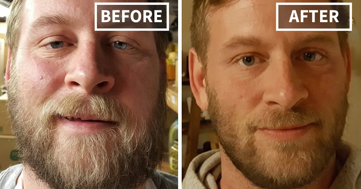 127 Before-And-After Pics Show What Happens When You Stop Drinking