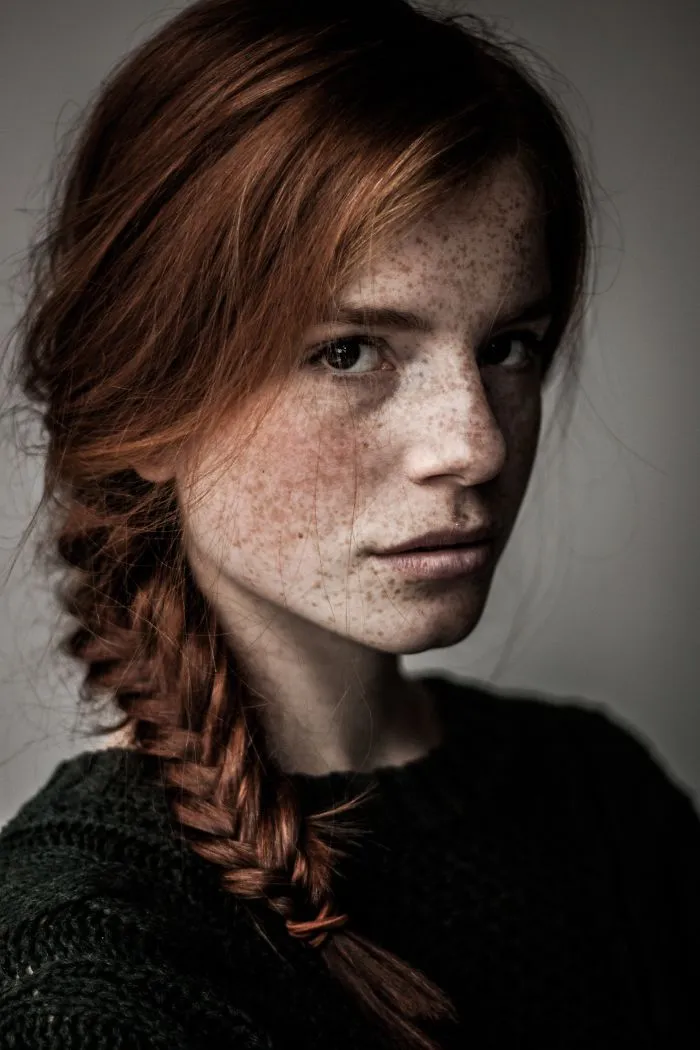 98 Freckled People Who'll Hypnotize You With Their Unique Beauty