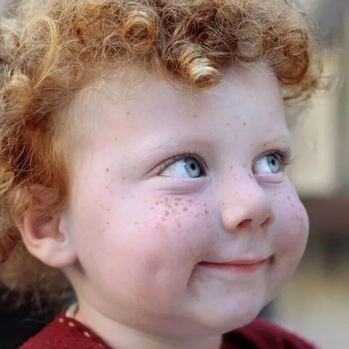 98 Freckled People Who'll Hypnotize You With Their Unique Beauty