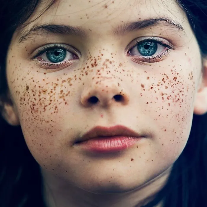 98 Freckled People Who'll Hypnotize You With Their Unique Beauty