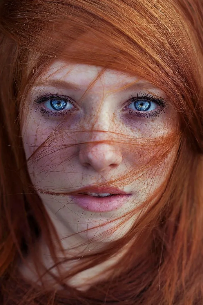 98 Freckled People Who'll Hypnotize You With Their Unique Beauty