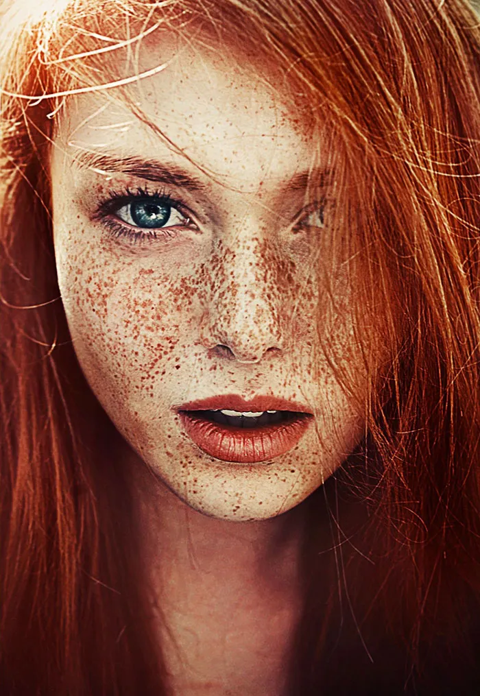 98 Freckled People Who'll Hypnotize You With Their Unique Beauty