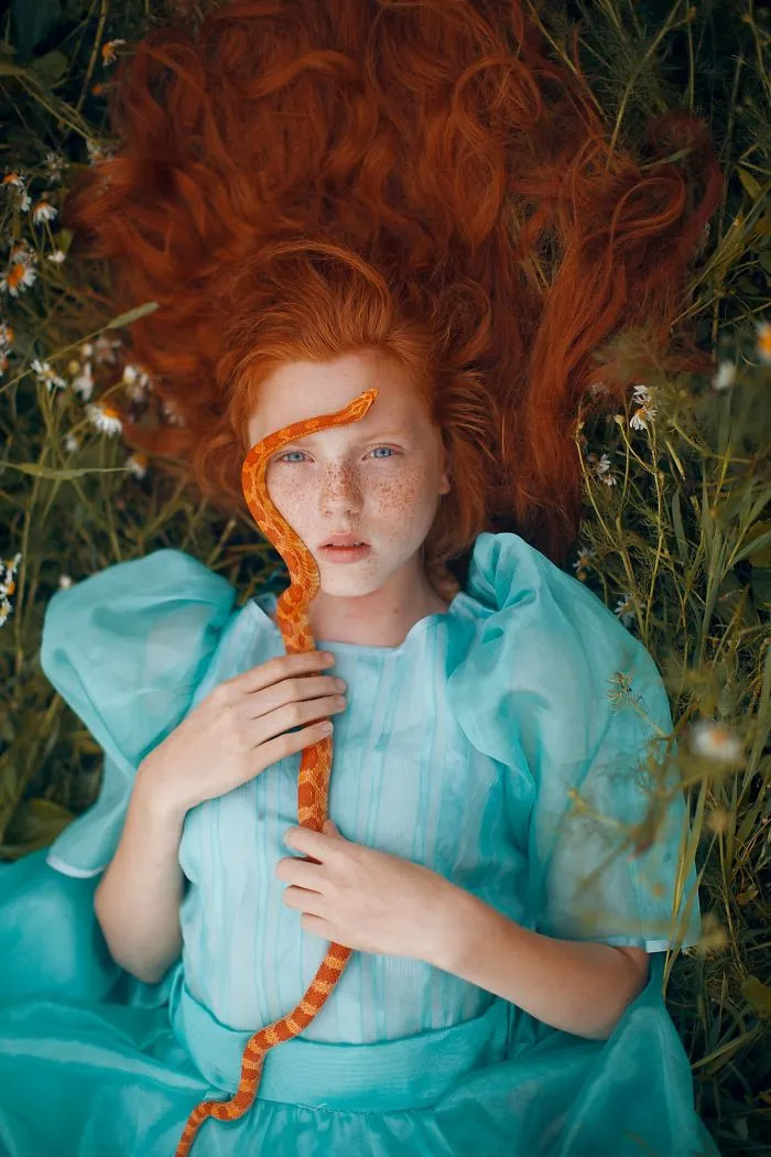 98 Freckled People Who'll Hypnotize You With Their Unique Beauty