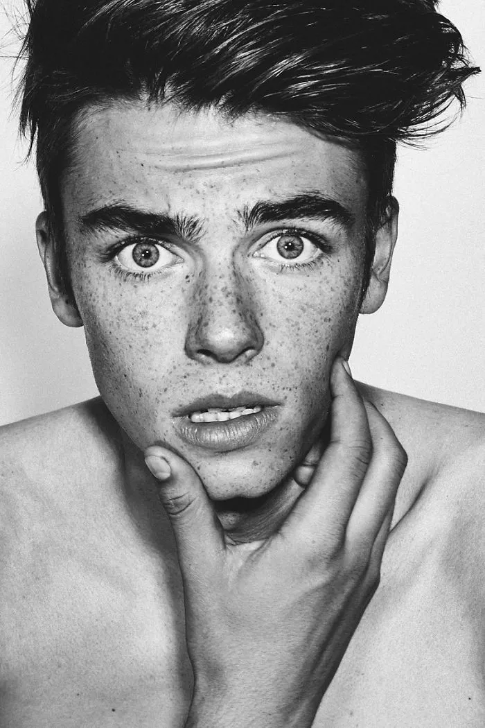 98 Freckled People Who'll Hypnotize You With Their Unique Beauty