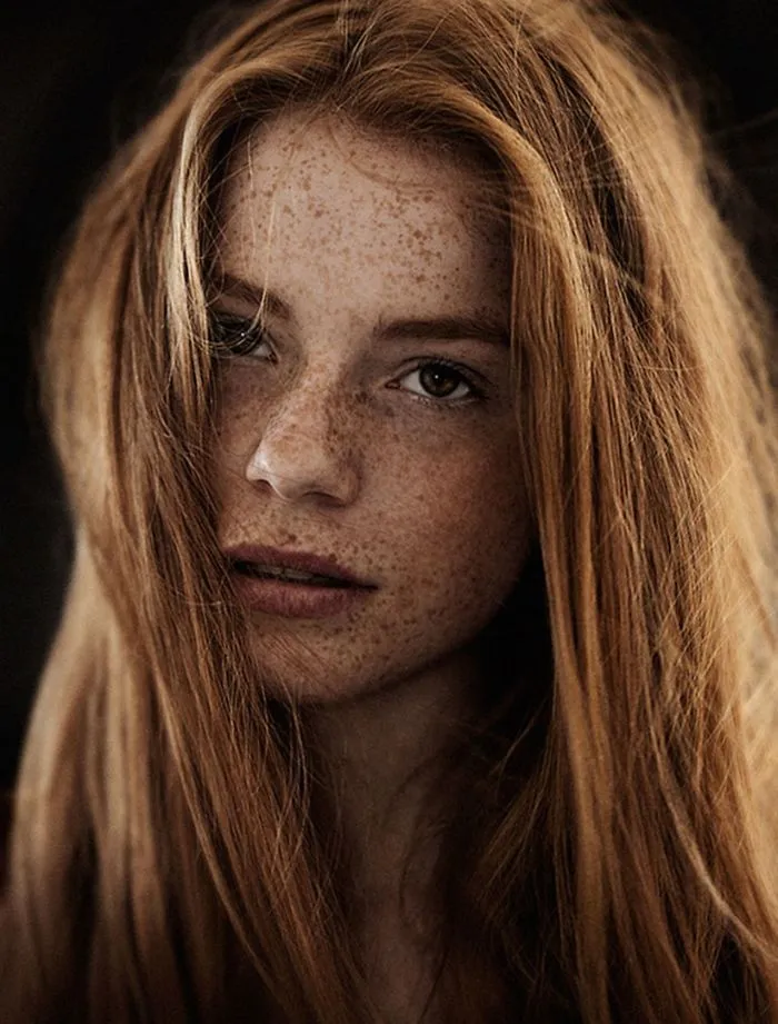 98 Freckled People Who'll Hypnotize You With Their Unique Beauty