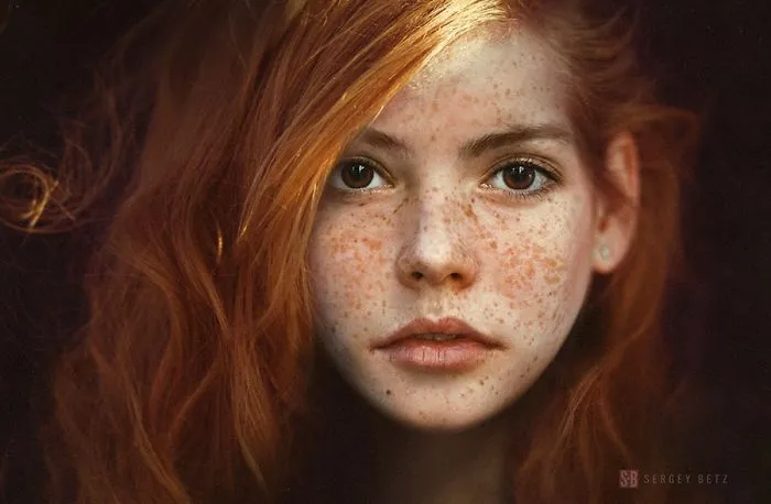 98 Freckled People Who'll Hypnotize You With Their Unique Beauty
