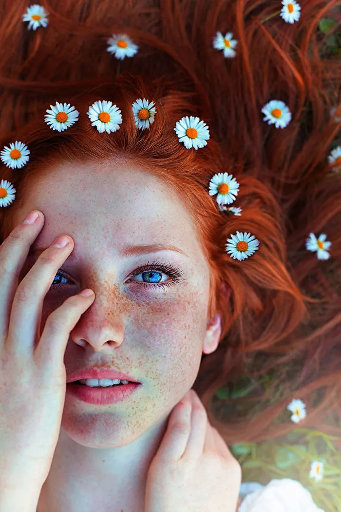 98 Freckled People Who'll Hypnotize You With Their Unique Beauty