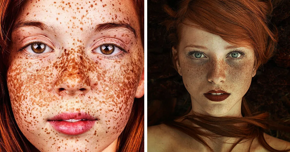 15 Personas con pecas que te hipnotizarán con su belleza única