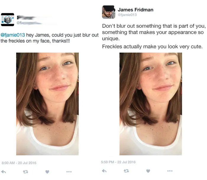 Freckles Deserve Spotlight