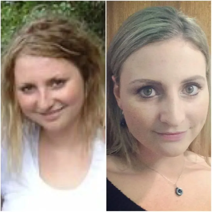 Side-by-side before and after photos showing facial changes after quitting drinking, highlighting clear skin and brighter eyes.