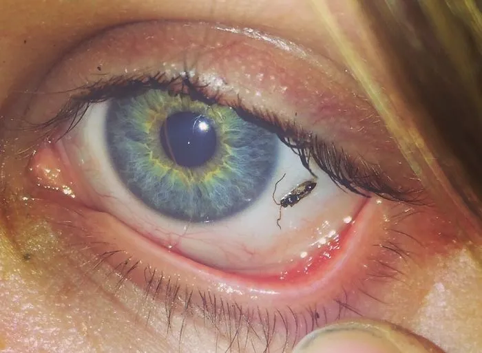 My Amazing Eye Collection