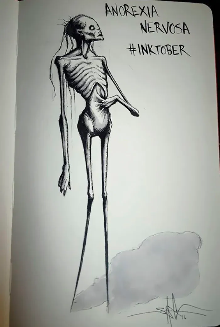 Anorexia Nervosa