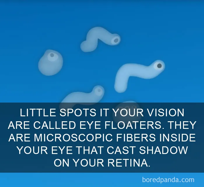 Abstract illustration of eye floaters, microscopic fibers in the eye casting shadows on the retina, with text about vision.