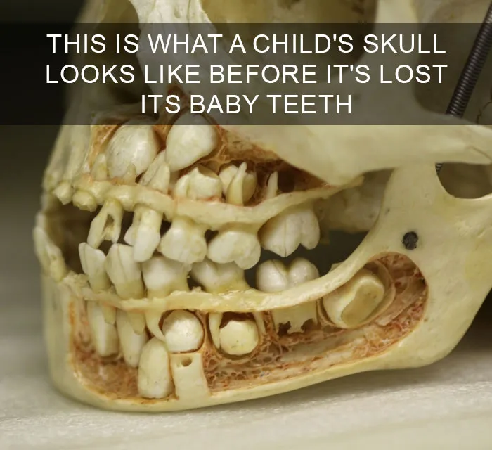 Too Many Teeth Times