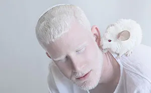 I Captured The Hypnotizing Beauty Of Albino People