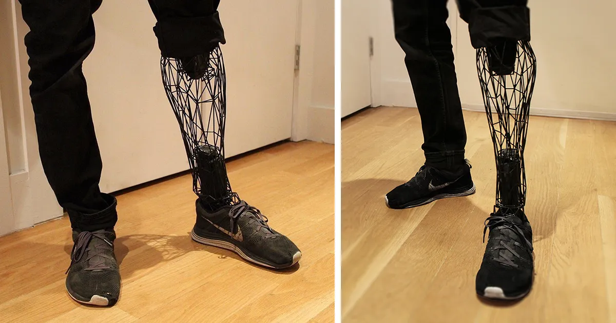 Increíbles prótesis impresas en 3D con titanio