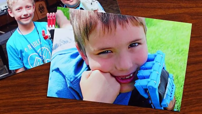 Open Source Technology Used In The Most Incredible Way To Give Kids Prosthetic Limbs