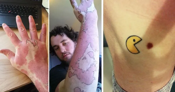 35 Genius Birthmark Cover-Up Tattoos
