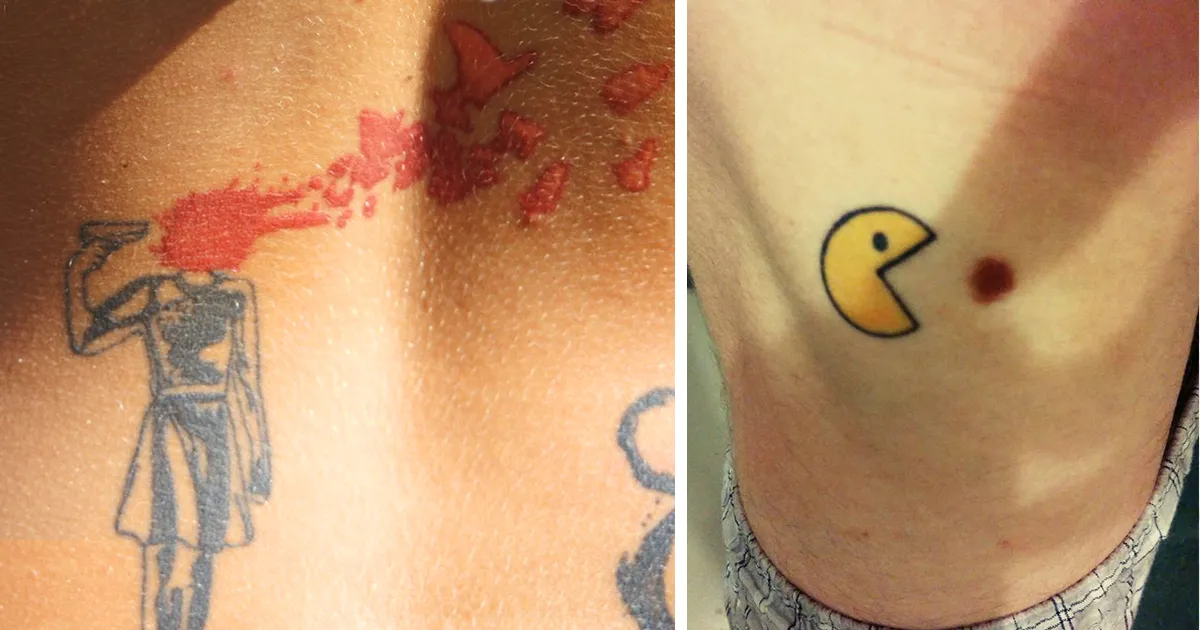 15 Ingeniosos tatuajes para "cubrir" marcas de nacimiento