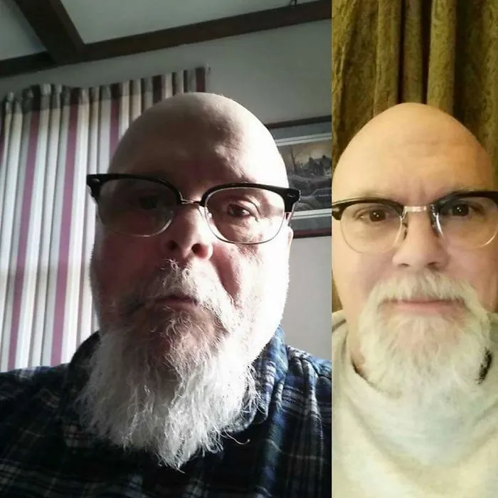 Two men with similar features, bald, glasses, and white beards, mirror each other like real-life doppelgangers.
