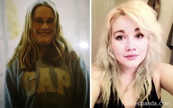 Still Don't Think I'm Quite Over The Syndrome, But I Do Know I'm Heaps Better