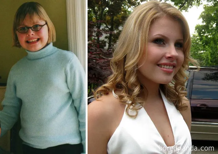 My Prepubescent Grandma-esque Appearance Is Still The Butt Of Many Jokes From Friends And Family Today