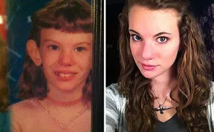 People Share Their Incredible "Ugly Duckling" Transformations And It's Hard To Believe They're The Same People