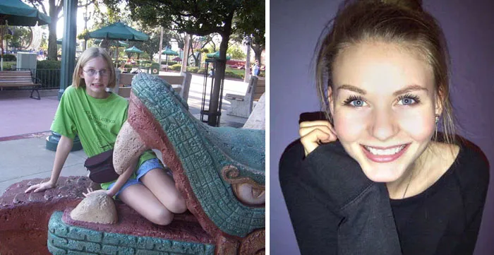 I Went Through A Mega-Awkward Stage