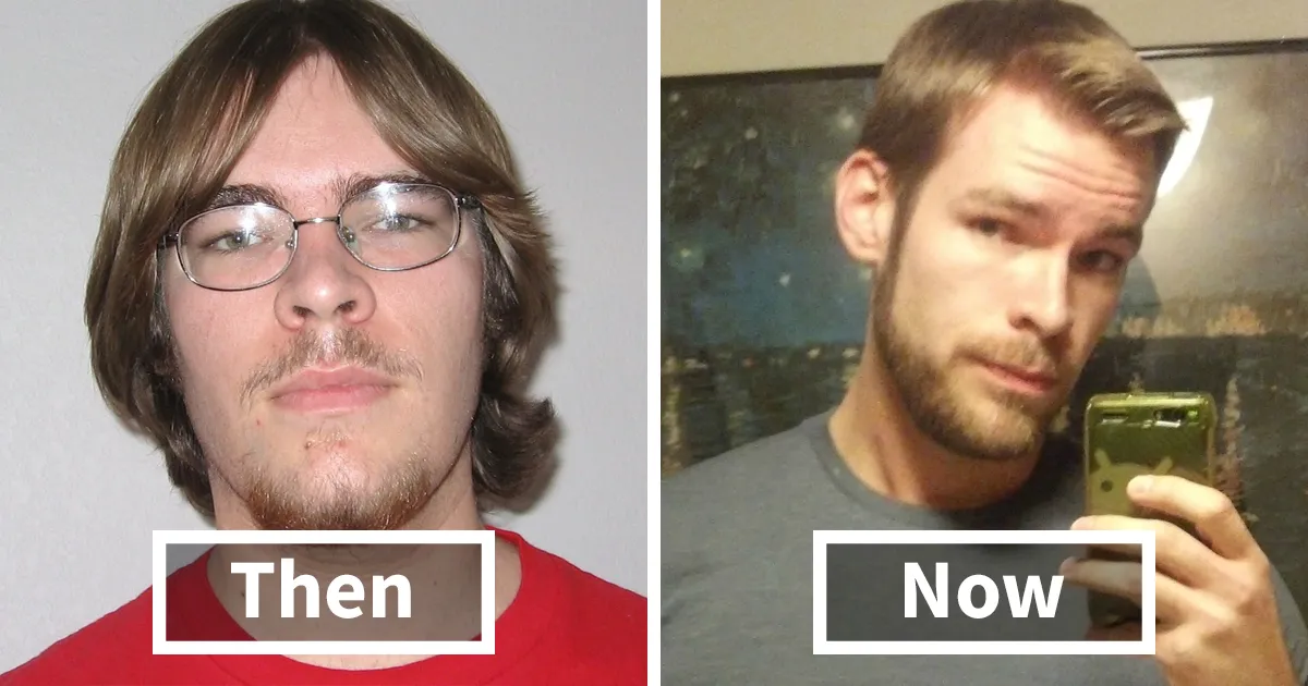 People Share Their Incredible "Ugly Duckling" Transformations And It's Hard To Believe They're The Same People