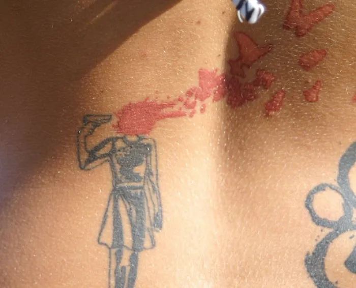 Birthmark Turned Into Art