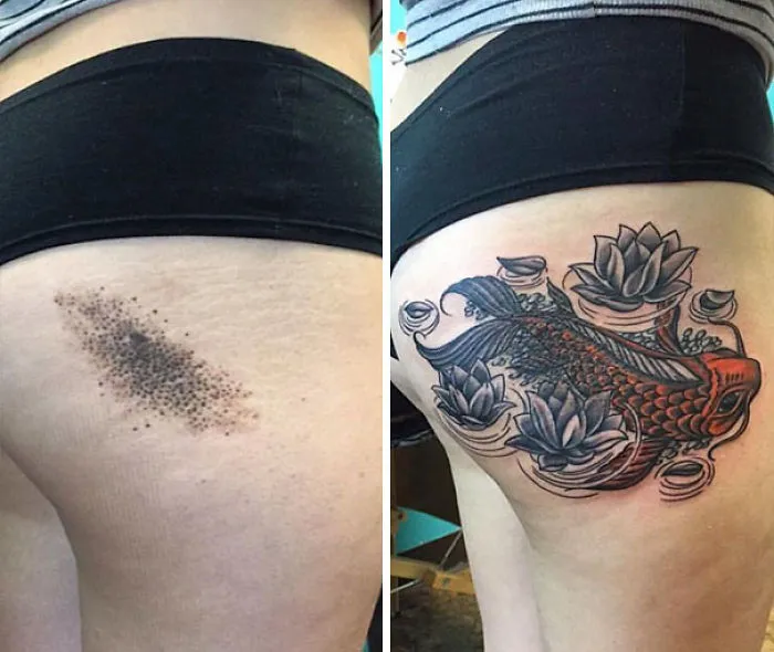 Birthmark Camouflage