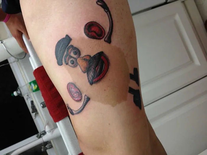 Mr. Potato Head Over Birthmark