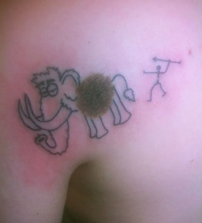 Woolly Birthmark. This Tattoo Grows Hair