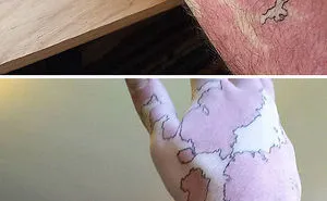 35 Genius Birthmark Cover-Up Tattoos