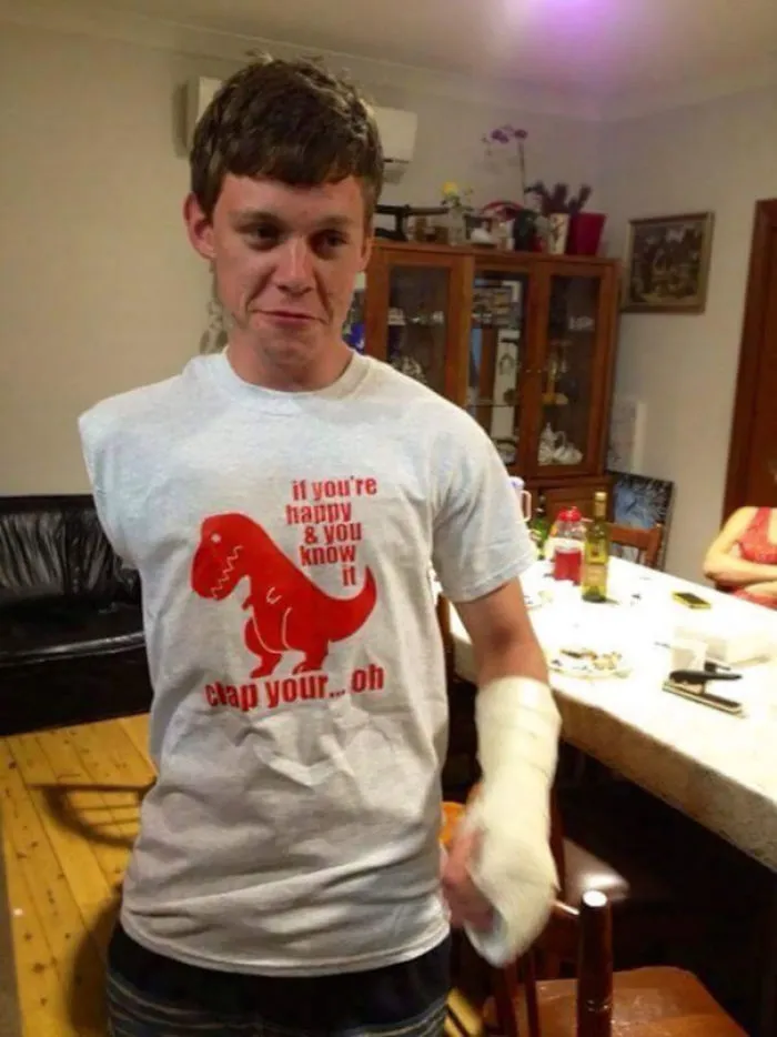 Lose Right Arm And Break My Left Hand Friend Gives Me This Shirt
