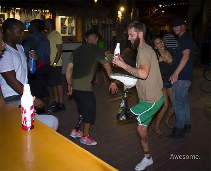 Prosthetic Leg