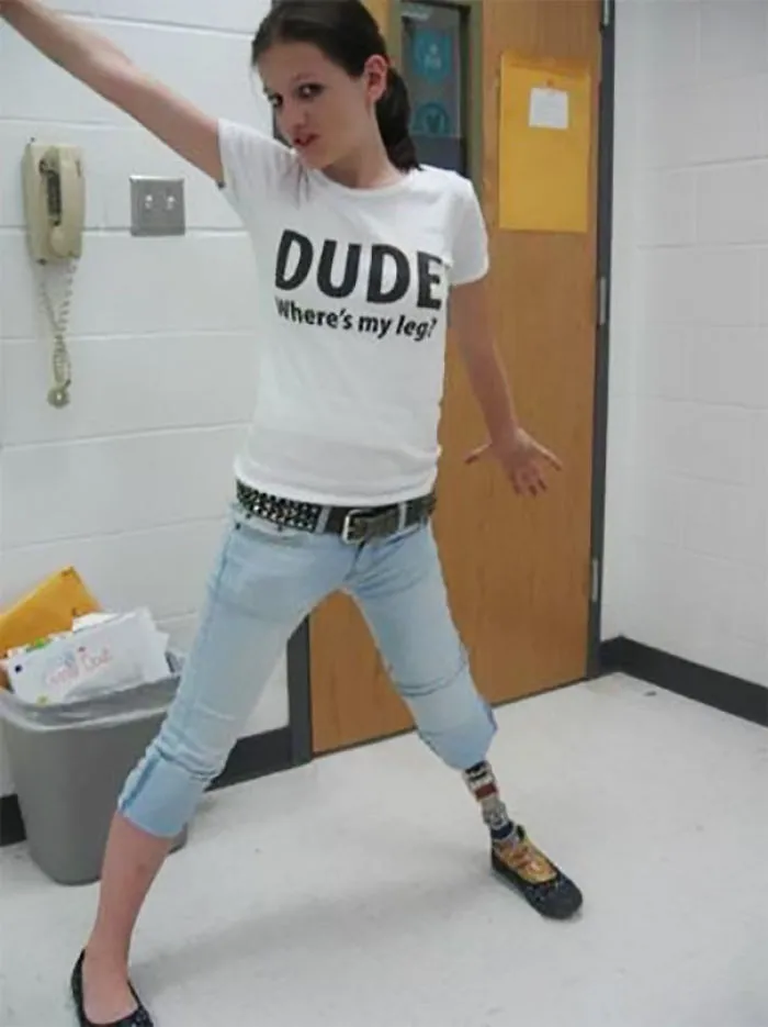 Dude Where's My Leg?