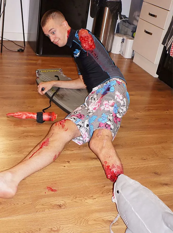 ‘Attacked By A Shark’ Halloween Costume