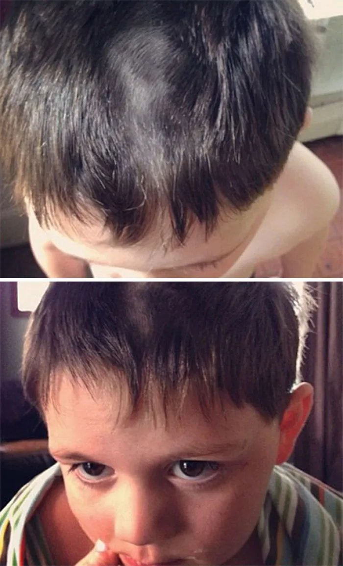 Child with a self-cut hairstyle, looking regretful, showing uneven bangs and short patches on top.
